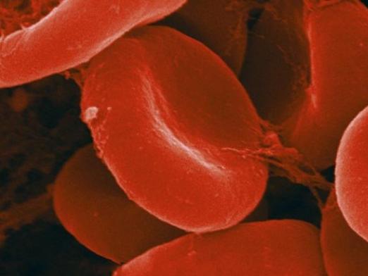 Mikä on alhaisen hemoglobiinin vaara?